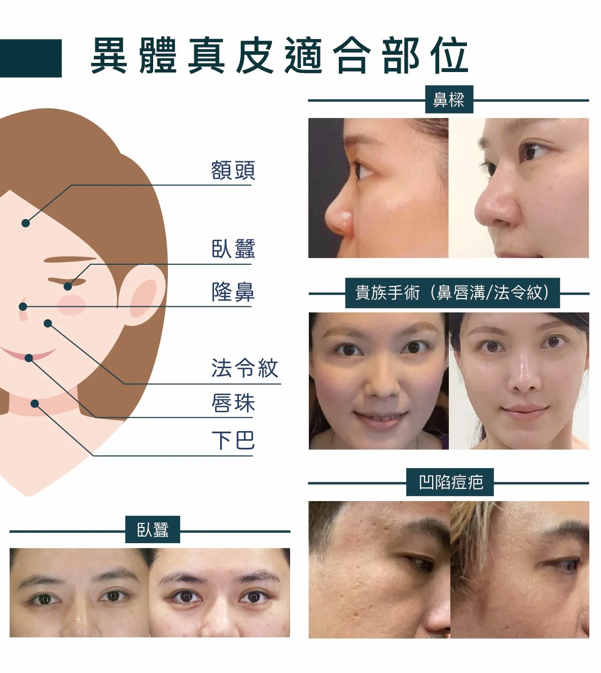 三折頁_異體真皮dm 直式 03 0 複製