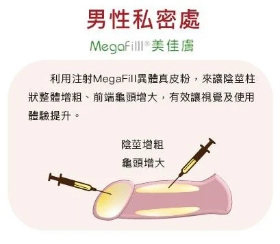 擷取1
