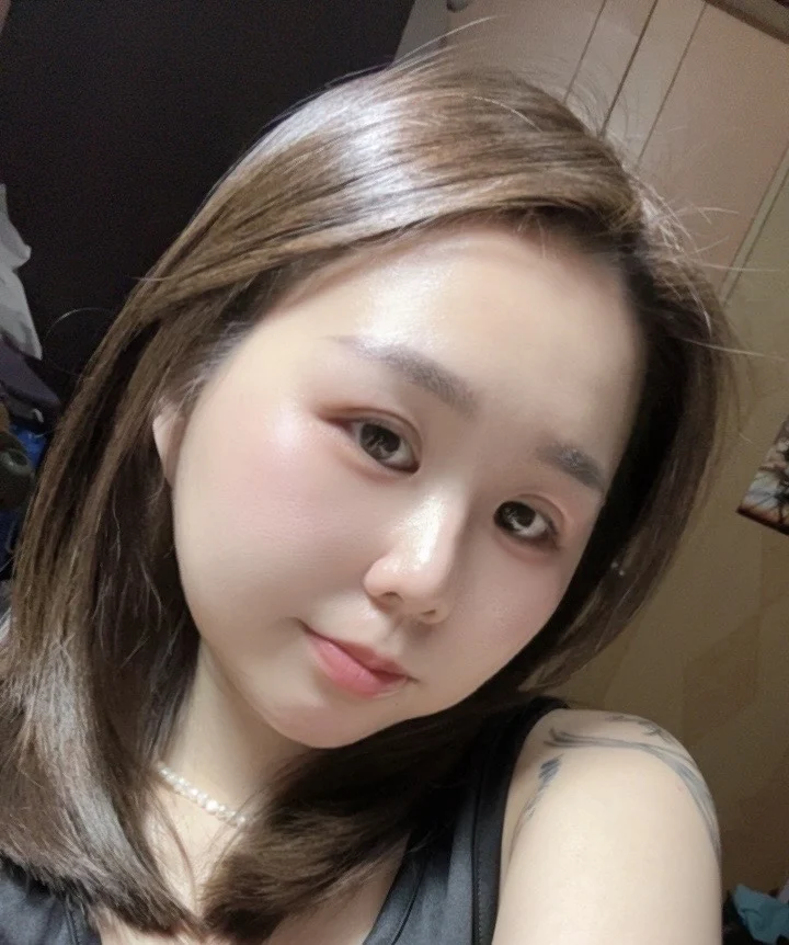 術後3個月 3