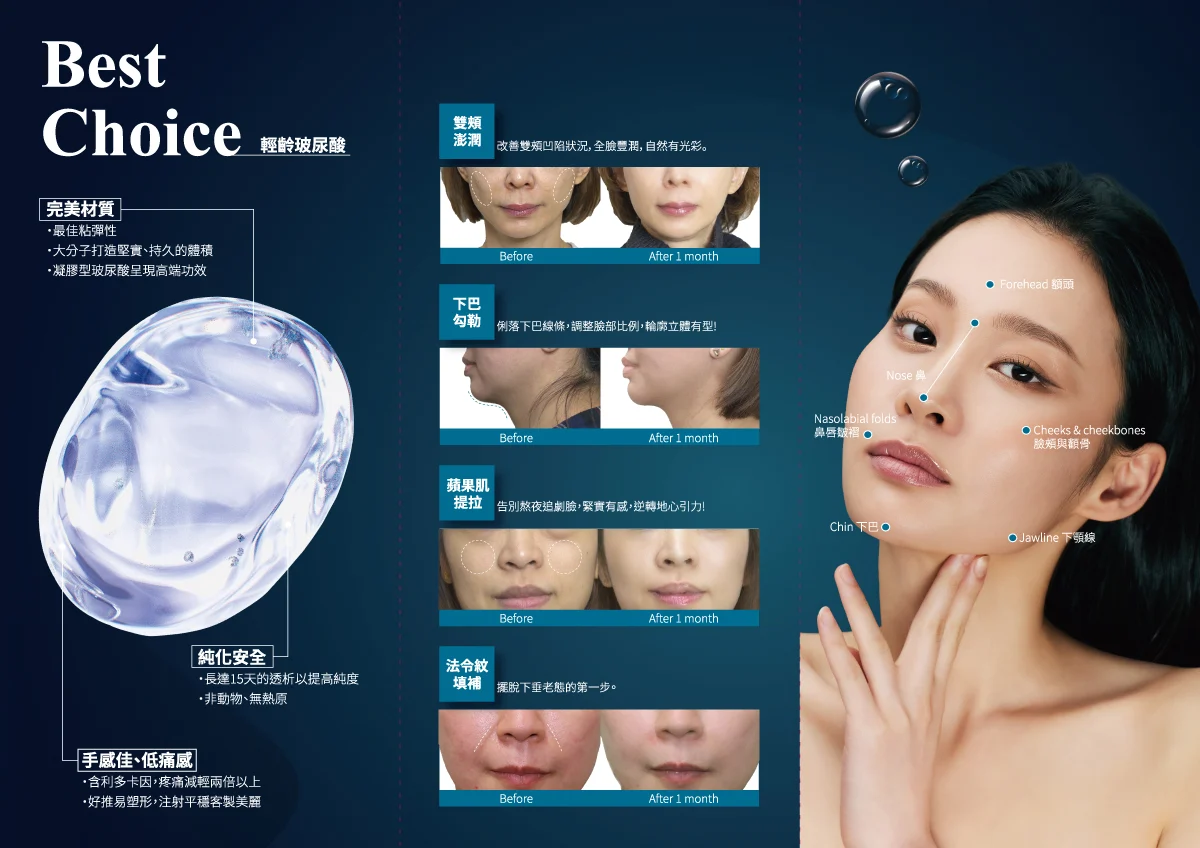 202502 玻尿酸三折dmout內