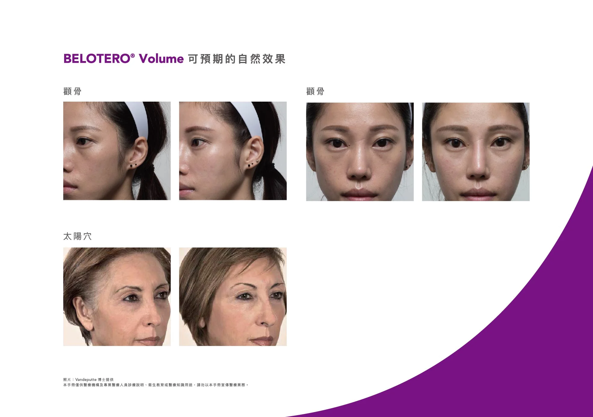 Belotero保柔緹 桌曆 0313 31