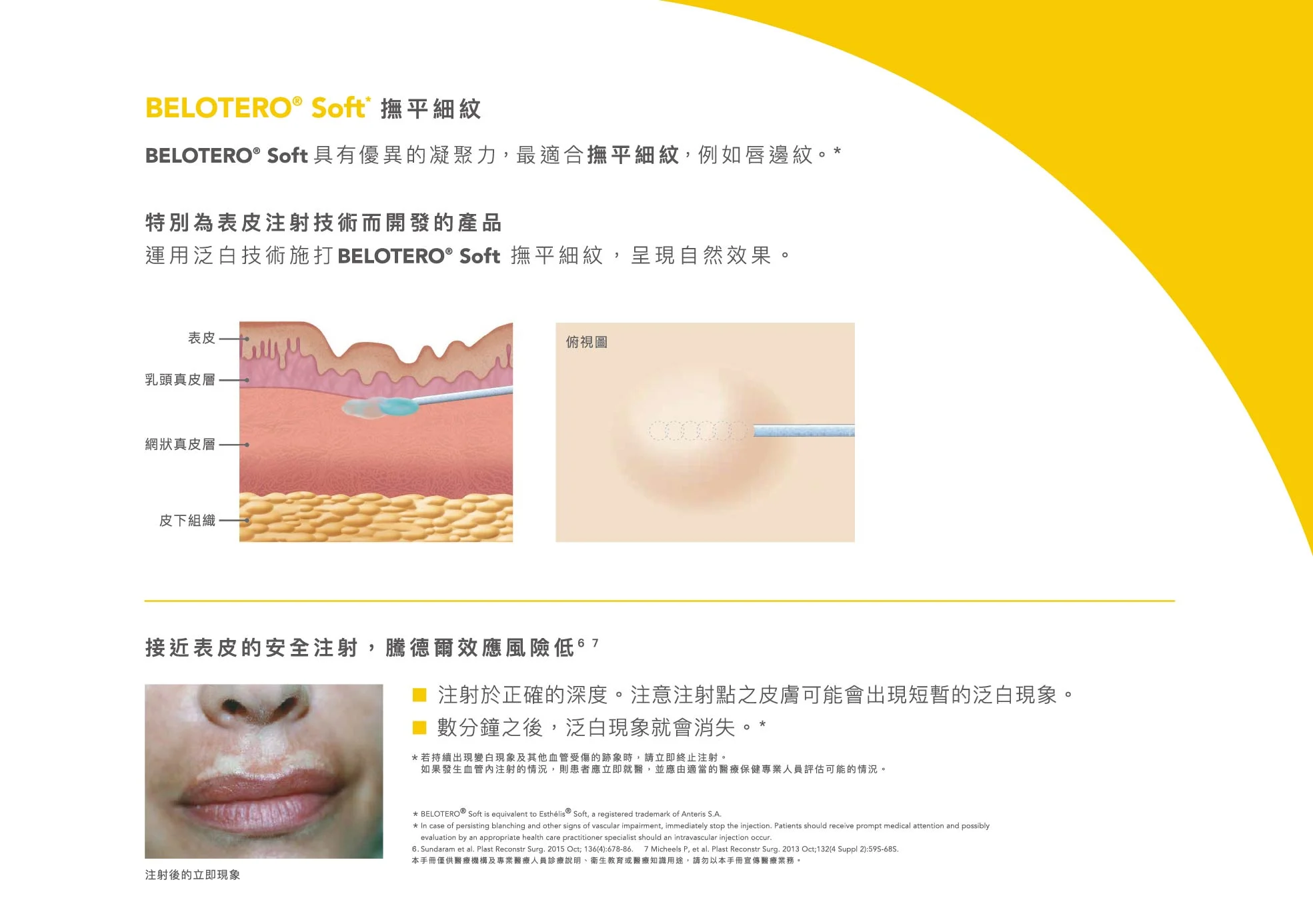 Belotero保柔緹 桌曆 0313 11