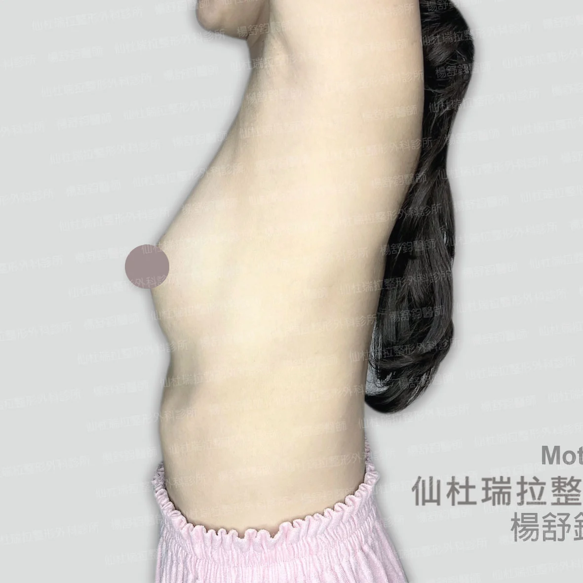 P059