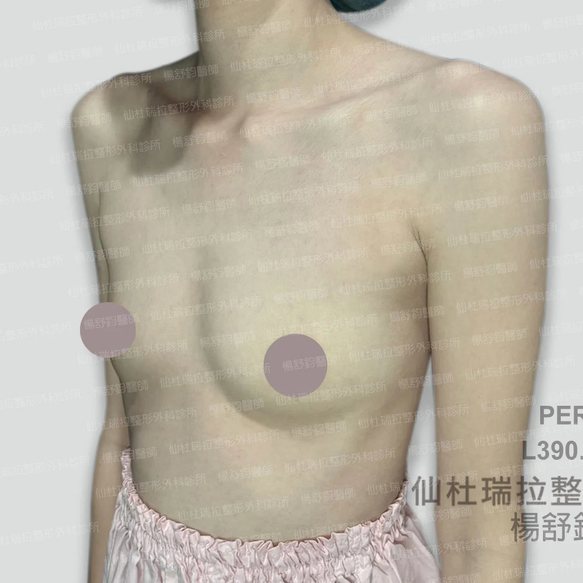 P039