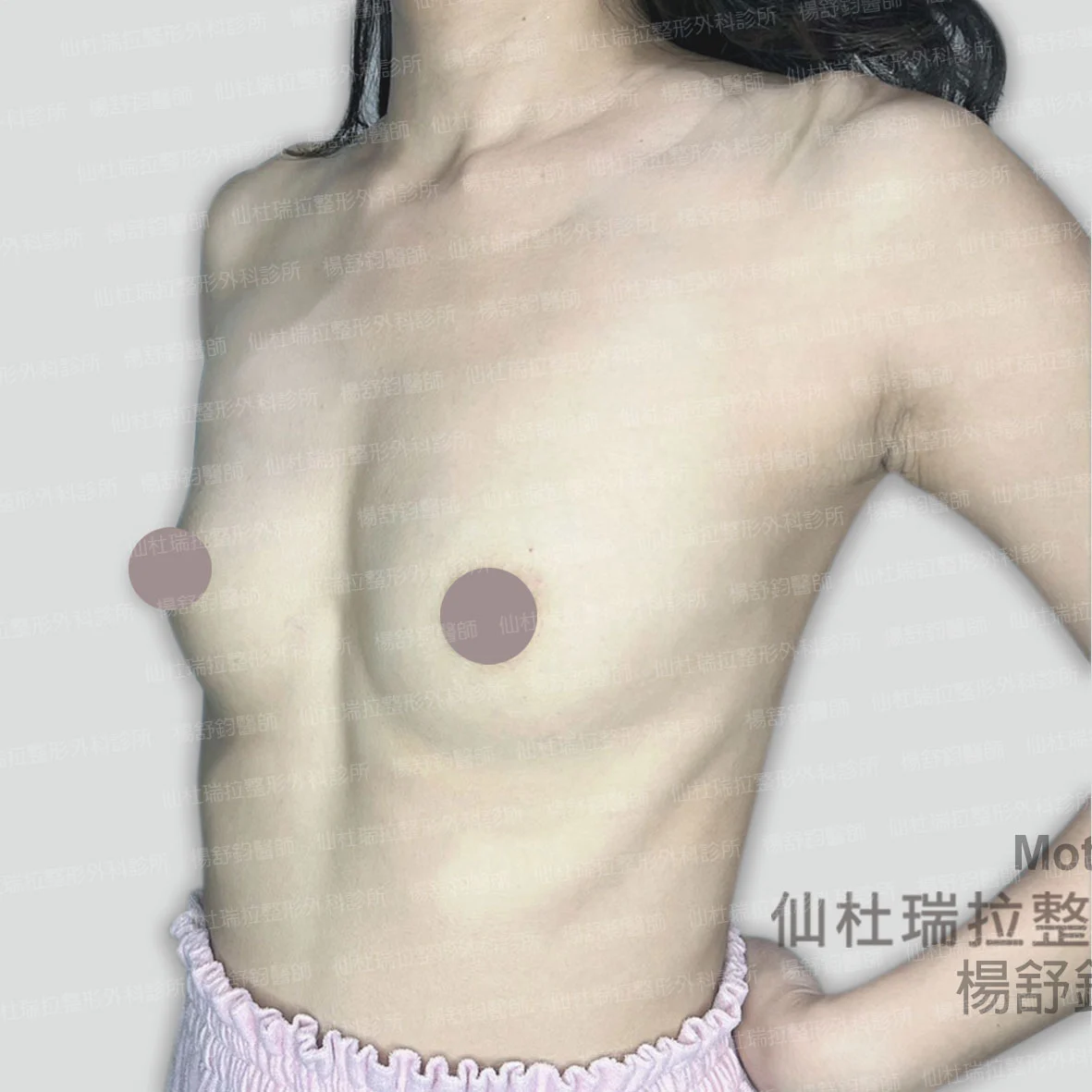 P057
