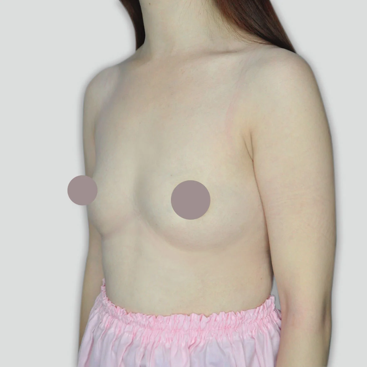 P033
