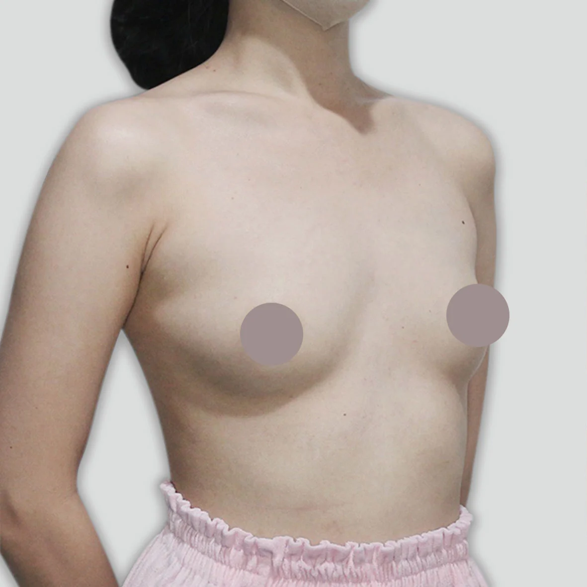 P051