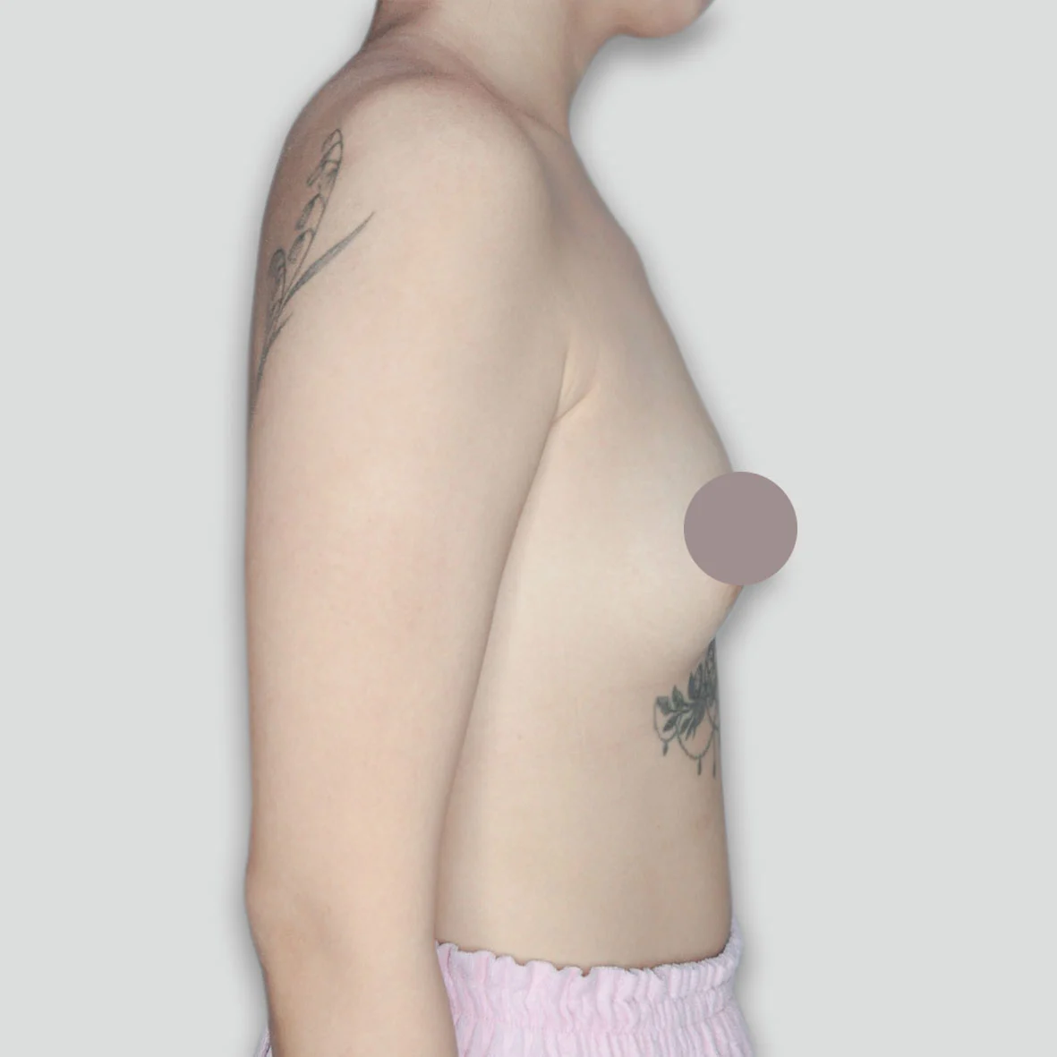 P017