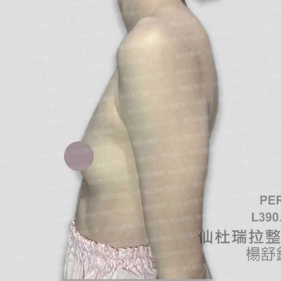 P041