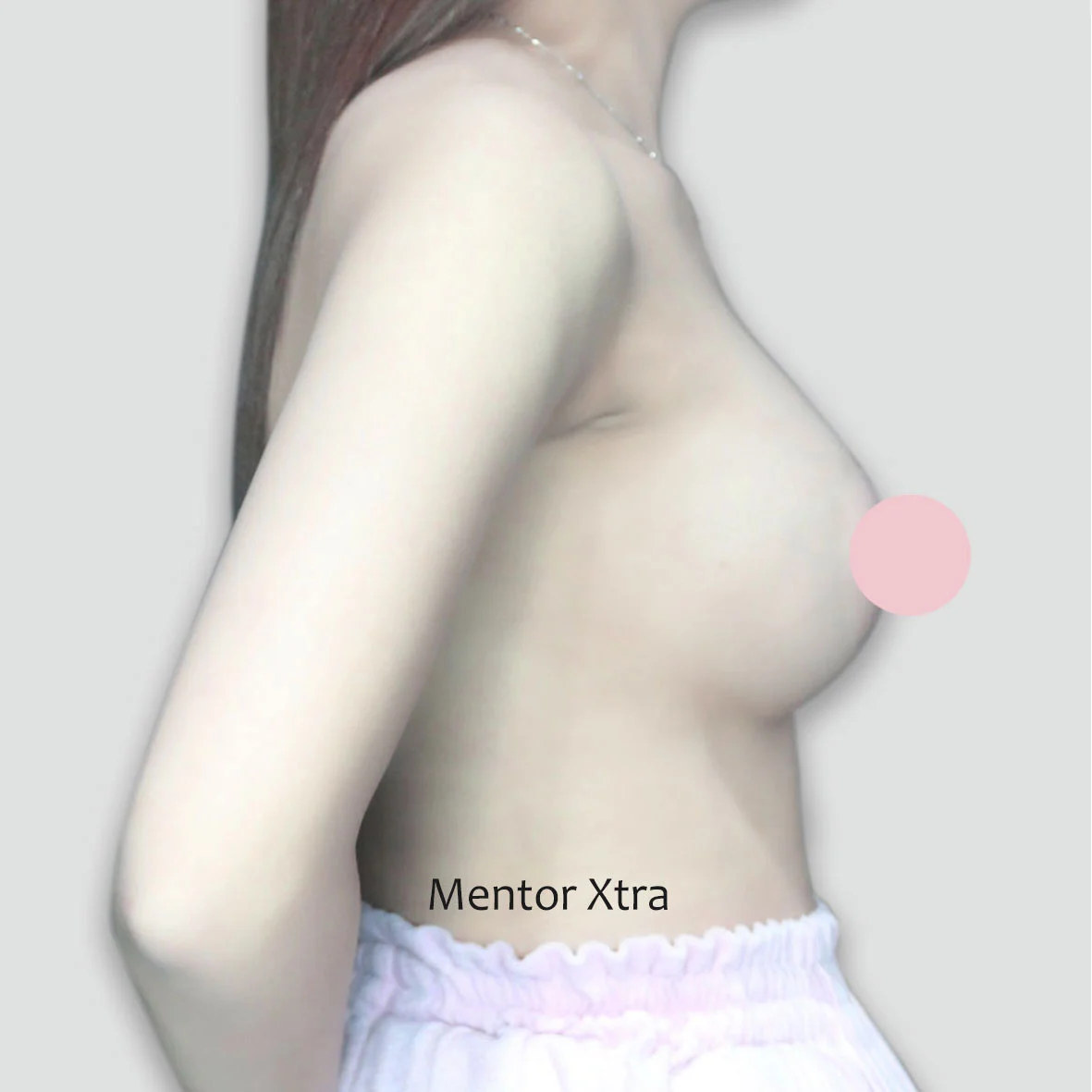 P012