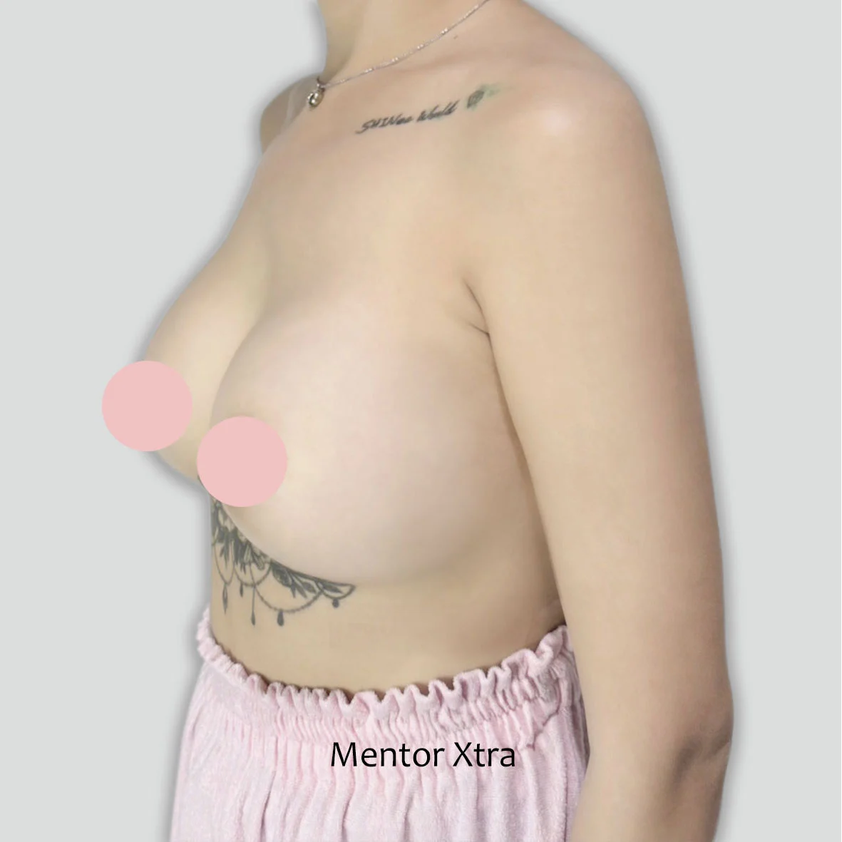 P016