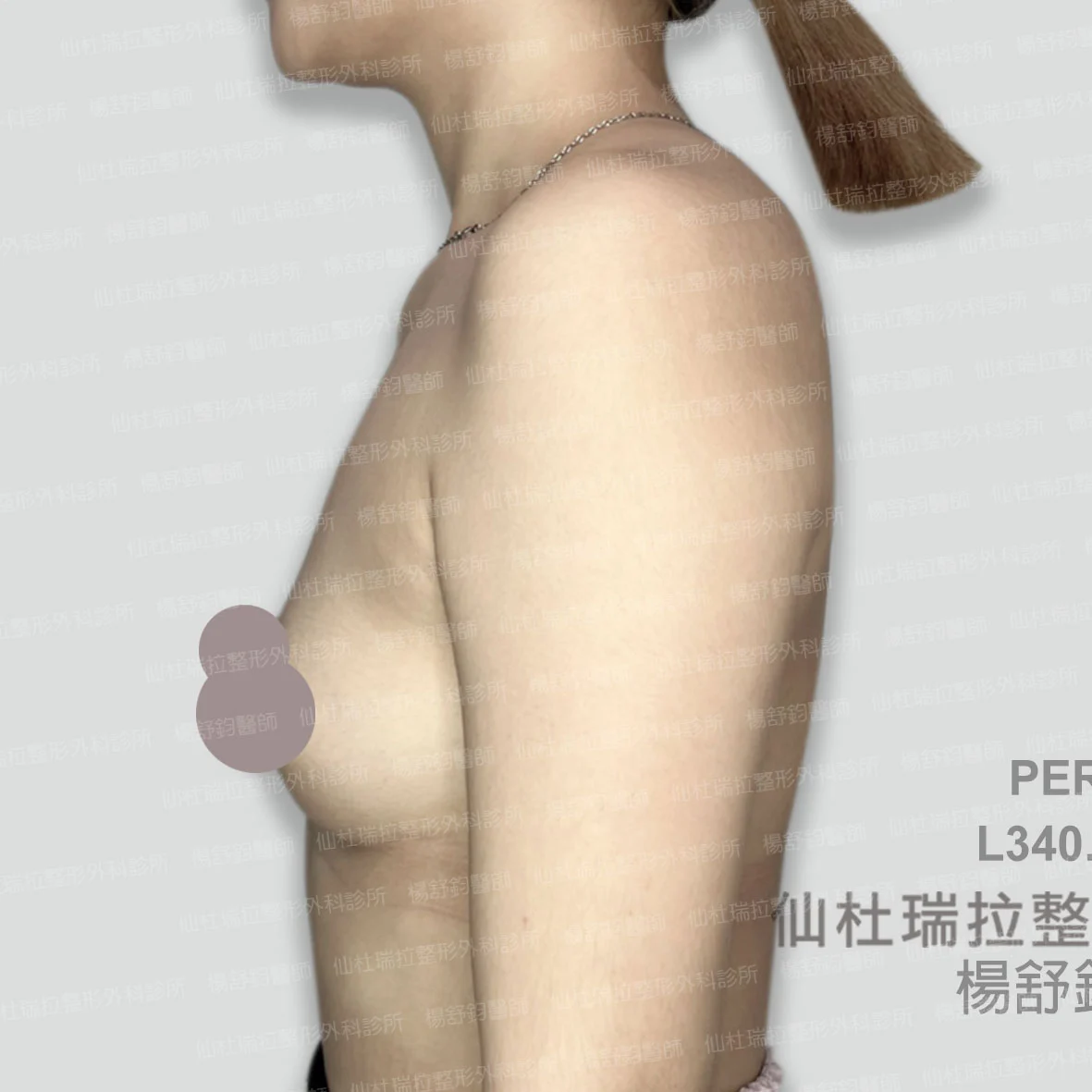 P029