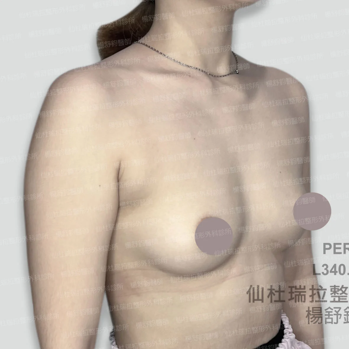 P027