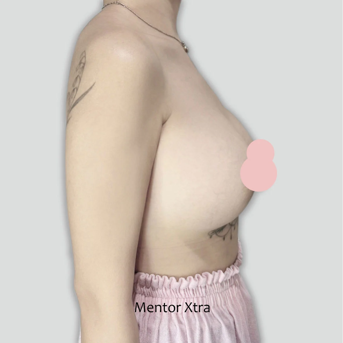 P018