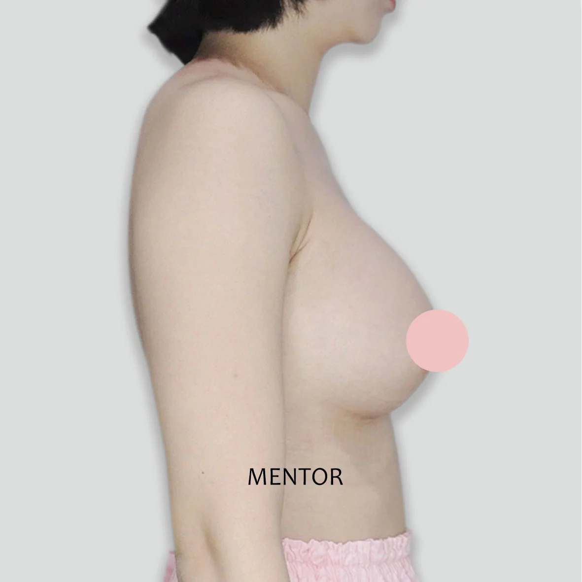 P054