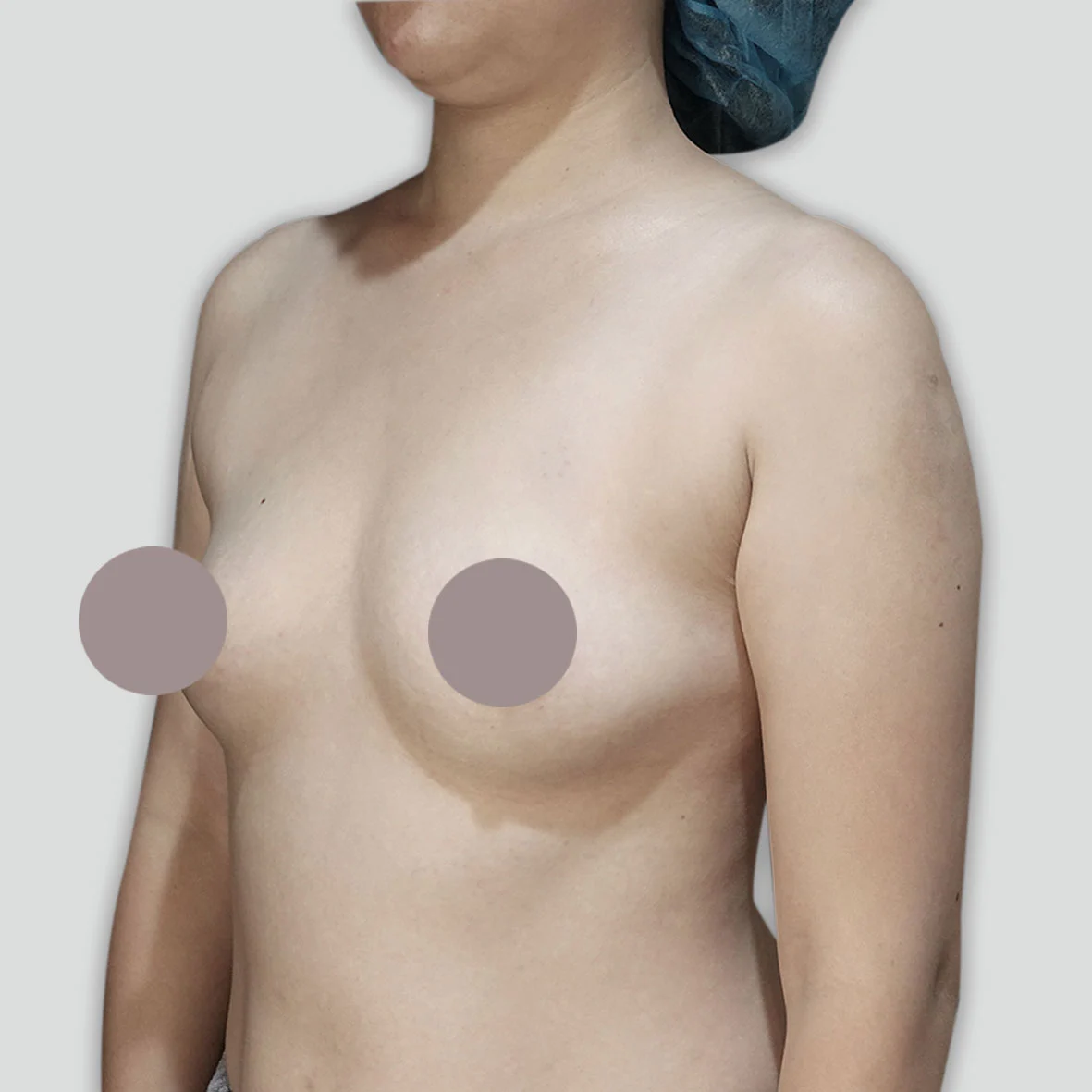 P343