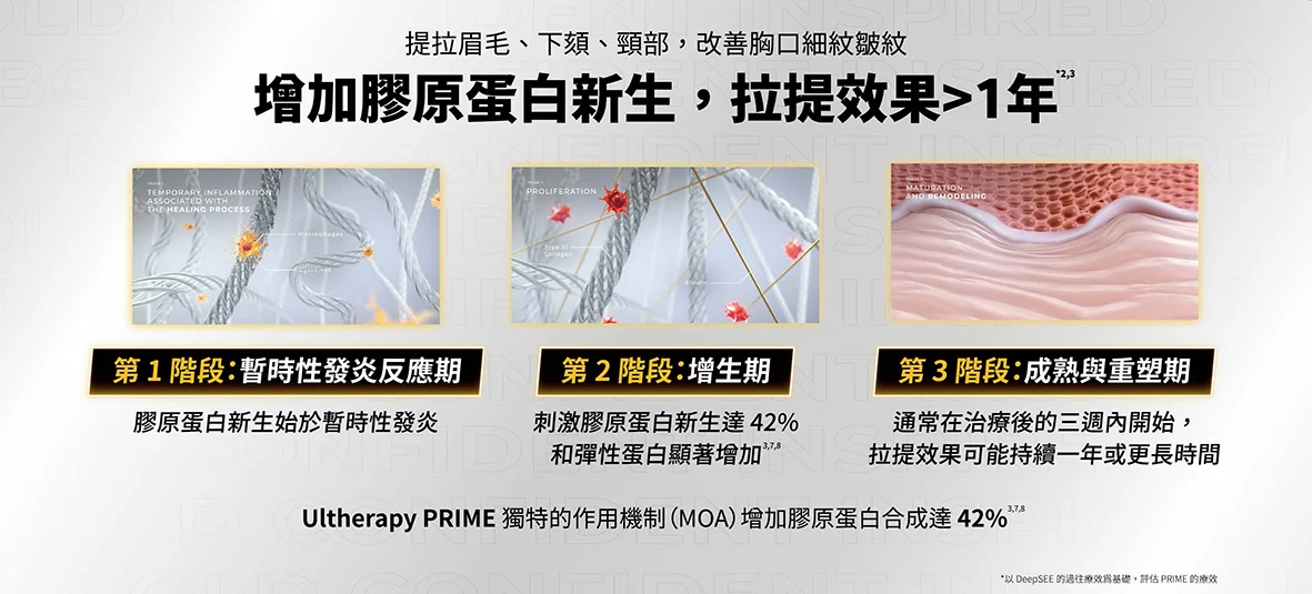 Ultherapy Prime美國音波極透 精裝手冊 1140409 頁面 16