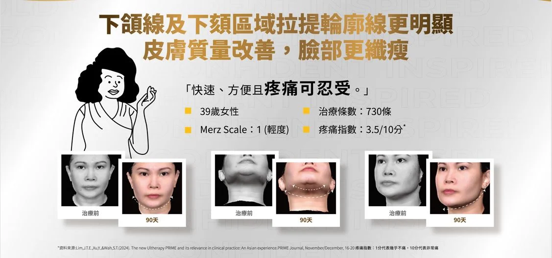 美音 5